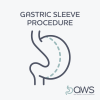 Gastric Sleeve Procedure