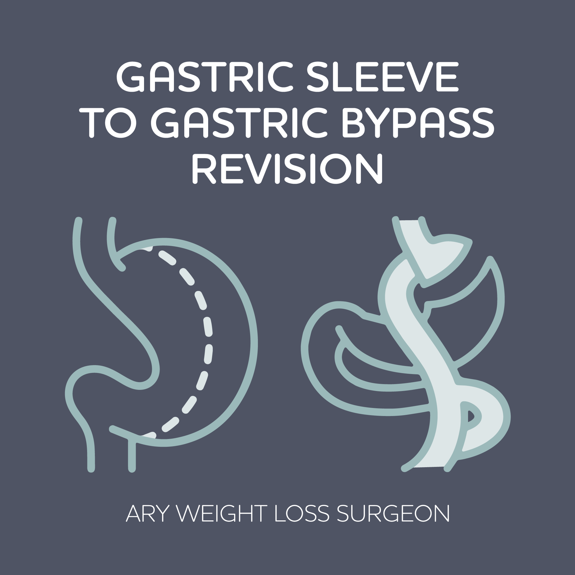 Gastric Sleeve to Gastric bypass revision 